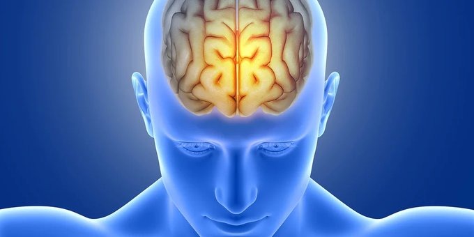 La migraña es un tipo de dolor de cabeza cuyo origen es atribuido a una actividad cerebral anormal y puede desencadenarse por múltiples factores (Freepik)